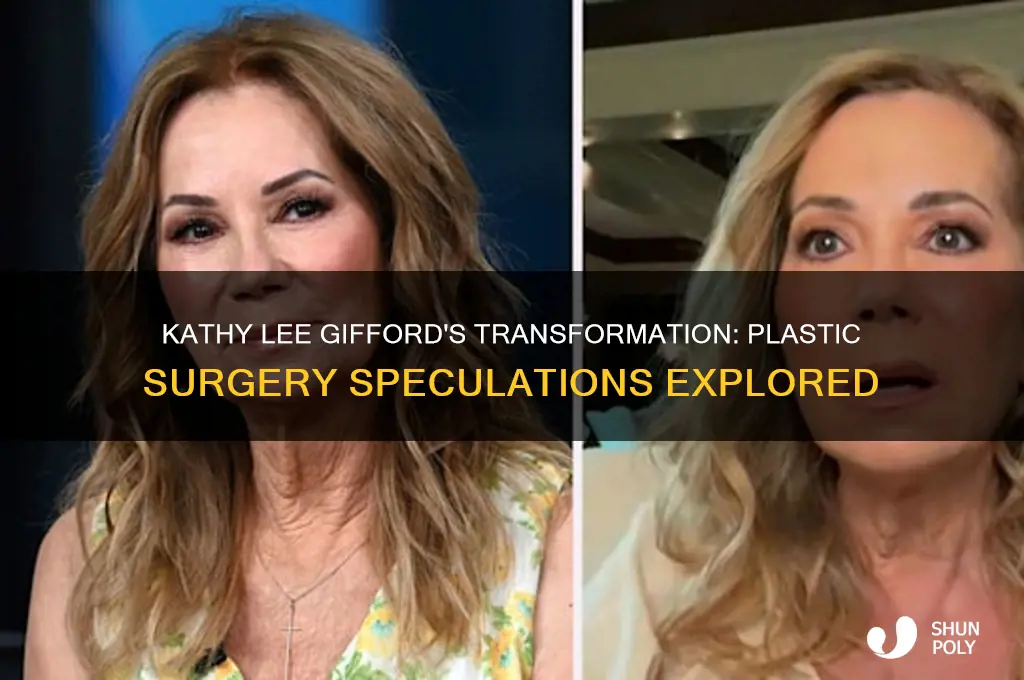 did kathy lee giffird get plastic surgery