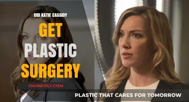 Katie Cassidy's Transformation: Plastic Surgery Rumors Explored and Debunked