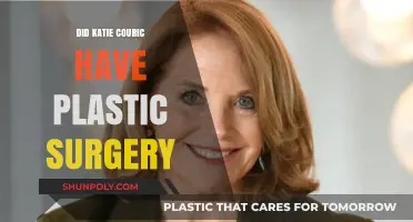 Katie Couric's Transformation: Plastic Surgery Rumors Explored and Debunked