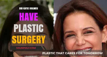 Katie Holmes Plastic Surgery: Fact-Checking the Rumors and Speculations
