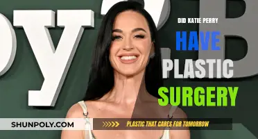 Katie Perry's Transformation: Plastic Surgery Rumors and Speculations Explored