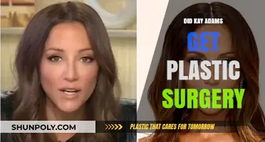 Kay Adams Plastic Surgery: Fact-Checking Rumors and Speculations