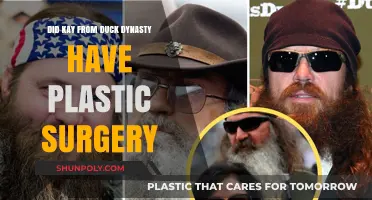Kay Robertson's Transformation: Plastic Surgery Rumors on Duck Dynasty