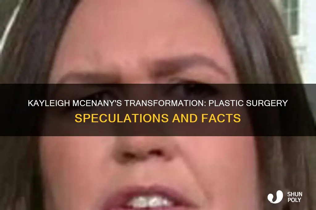 did kayleigh mcenany have plastic surgery