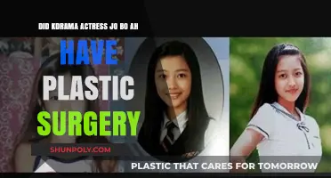 Jo Bo Ah's Transformation: Plastic Surgery Rumors Explored