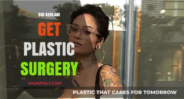 Kehlani's Transformation: Plastic Surgery Rumors and the Truth Revealed
