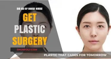 Kei from Goose House: Plastic Surgery Rumors Explored