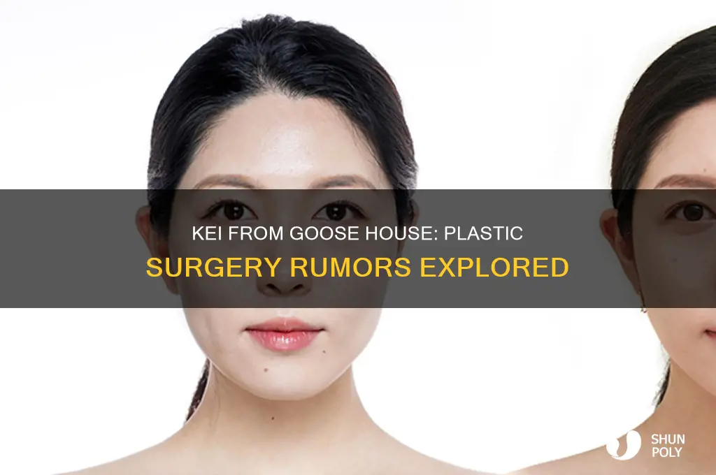 did kei of goose house get plastic surgery