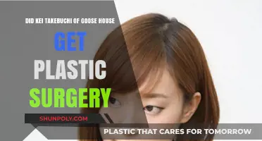 Kei Takebuchi's Transformation: Plastic Surgery Rumors Explored