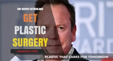 Keifer Sutherland's Transformation: Plastic Surgery Rumors Explored