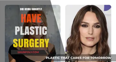 Keira Knightley's Transformation: Plastic Surgery Rumors Debunked