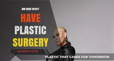 Keke Wyatt's Transformation: Plastic Surgery Rumors and Reality Revealed