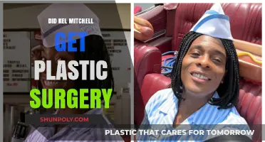 Kel Mitchell Plastic Surgery: Fact-Checking the Transformation Rumors