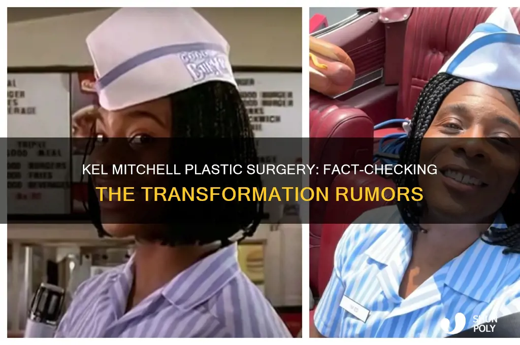 did kel mitchell get plastic surgery