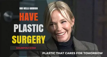 Kelli Giddish Plastic Surgery: Fact-Checking the Rumors and Speculations