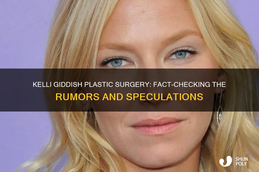 did kelli giddish have plastic surgery