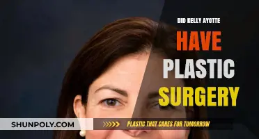 Kelly Ayotte Plastic Surgery: Fact-Checking the Rumors and Speculations