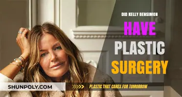 Kelly Bensimon's Transformation: Plastic Surgery Speculations and Truths