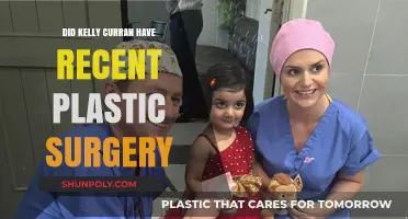 Kelly Curran's Recent Appearance: Plastic Surgery Speculations Explored