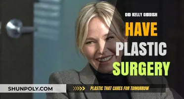 Kelly Giddish Plastic Surgery: Fact-Checking the Rumors and Speculations