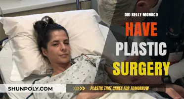 Kelly Monaco Plastic Surgery: Fact-Checking Her Transformation Rumors