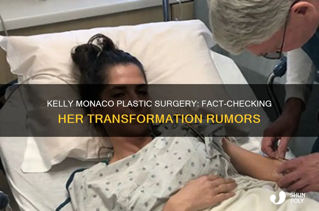 did kelly monoco have plastic surgery