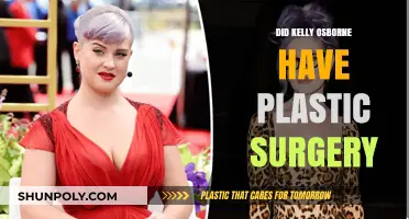 Kelly Osbourne's Transformation: Plastic Surgery Rumors Explored