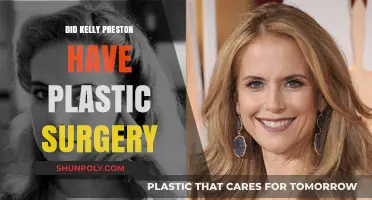 Kelly Preston's Transformation: Plastic Surgery Rumors and Reality