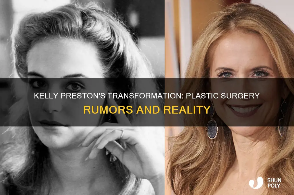 did kelly preston have plastic surgery