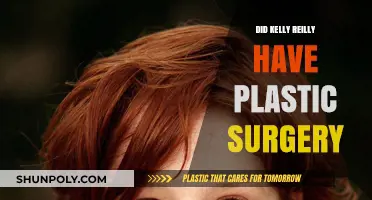 Kelly Reilly's Transformation: Plastic Surgery Rumors Explored and Debunked