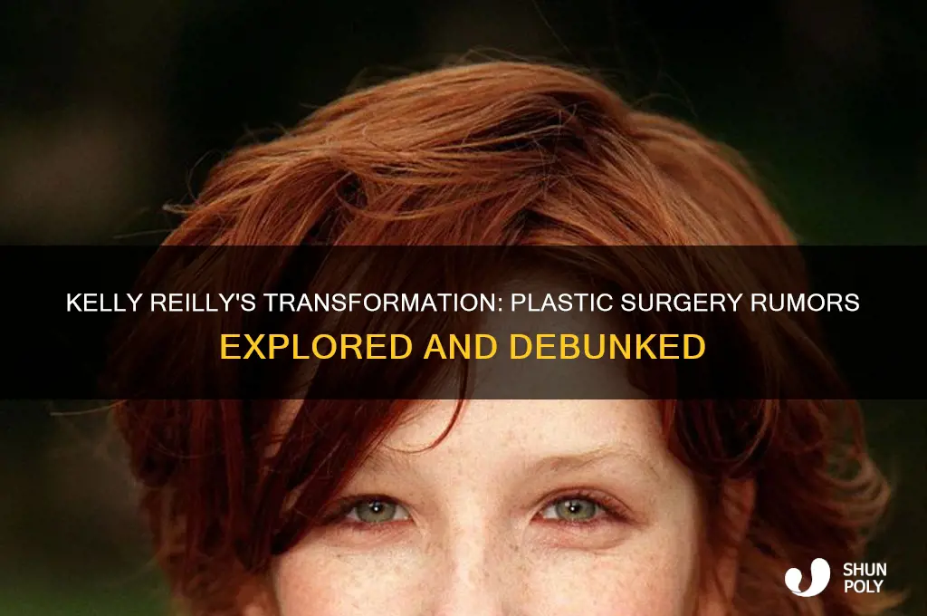 did kelly reilly have plastic surgery