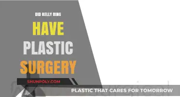 Kelly Ring's Transformation: Plastic Surgery Speculations and Truths Revealed