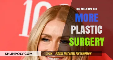 Kelly Ripa's Evolving Look: More Plastic Surgery Rumors Explored