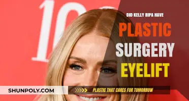 Kelly Ripa's Eyelift: Plastic Surgery Speculations and Truths