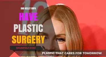 Kelly Ripa Plastic Surgery: Fact-Checking Her Transformation Rumors
