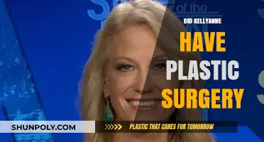 Kellyanne Conway's Transformation: Plastic Surgery Speculations and Truths Revealed