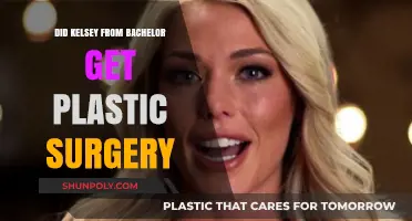 Kelsey Weier's Transformation: Plastic Surgery Rumors Explored and Debated