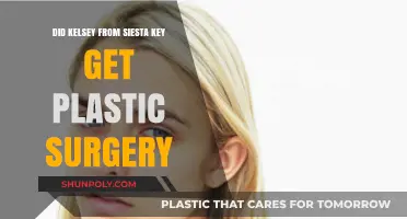 Did Kelsey Owens from Siesta Key Undergo Plastic Surgery?