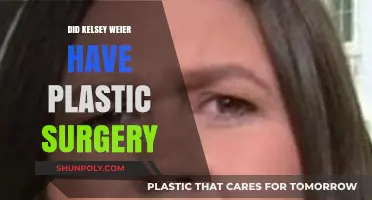 Kelsey Weier's Transformation: Plastic Surgery Rumors Explored and Debunked