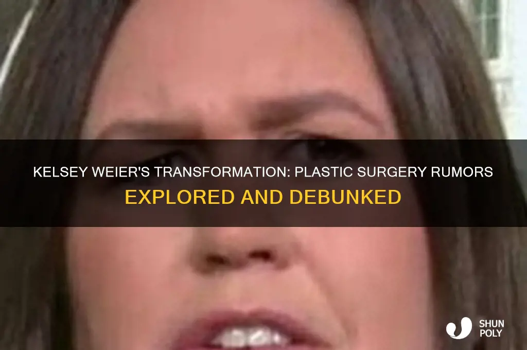 did kelsey weier have plastic surgery