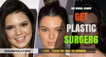 Kendal Jenner's Transformation: Plastic Surgery Rumors Explored