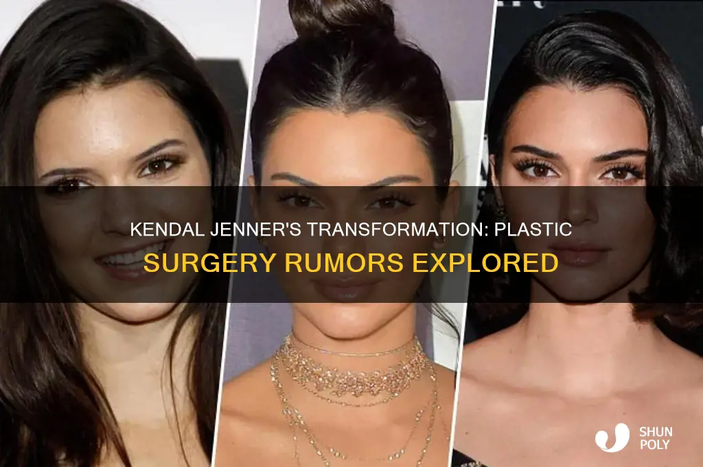 did kendal jenner get plastic surger6
