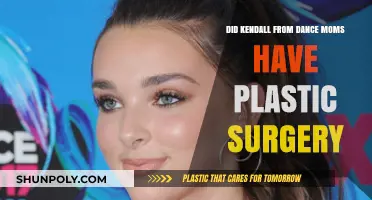 Kendall Vertes Plastic Surgery: Unveiling the Dance Moms Star's Transformation