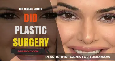 Kendall Jenner Plastic Surgery: Fact or Fiction? Uncovering the Truth