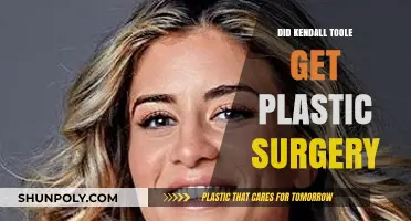 Kendall Toole Plastic Surgery Rumors: Fact or Fiction?