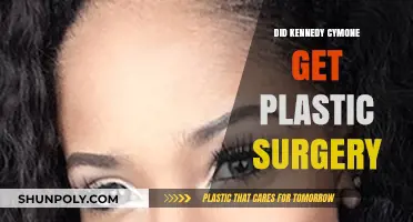 Did Kennedy Cymone Undergo Plastic Surgery? Unveiling the Truth