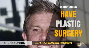 Did Kenny Johnson Undergo Plastic Surgery? Unveiling the Truth