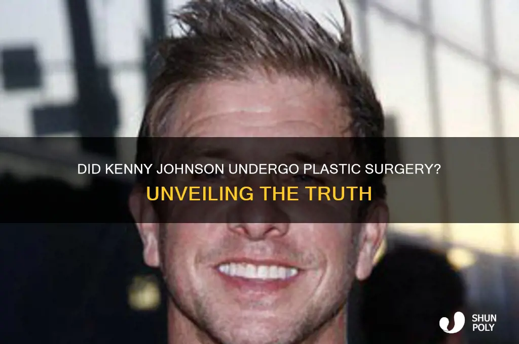 did kenny johnson have plastic surgery