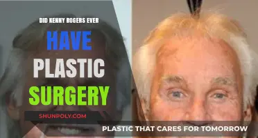 Kenny Rogers' Transformation: Plastic Surgery Speculations and Truths