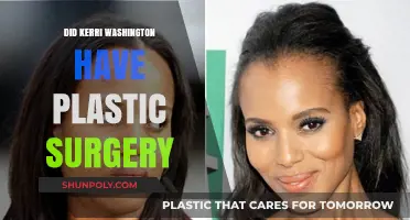 Kerri Washington Plastic Surgery Rumors: Fact or Fiction?